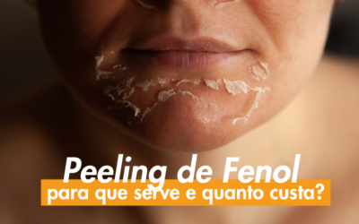 Peeling de fenol: para que serve e quanto custa?