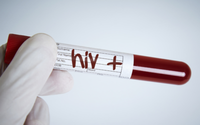 Nova variante do HIV é identificada em três estados