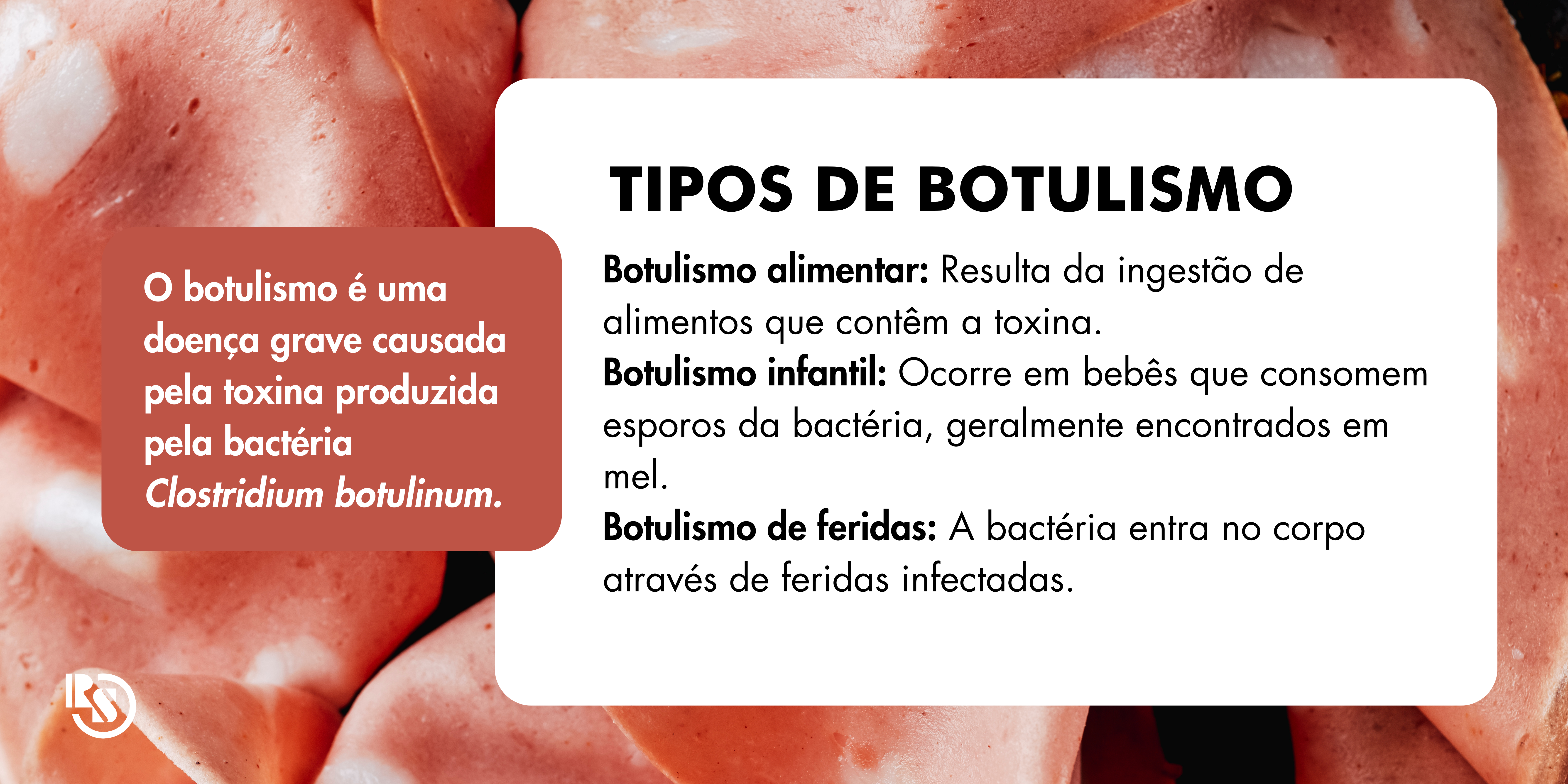 BOTULISMO