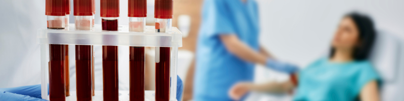 Como o linfoma de Hodgkin é diagnosticado Como o linfoma de Hodgkin é diagnosticado