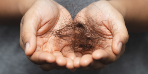 Sertralina causa queda de cabelo Entenda a relação!